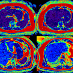 Núcleo Milenio Cardio MR organiza novedoso ciclo de talleres con los últimos avances en resonancia magnética